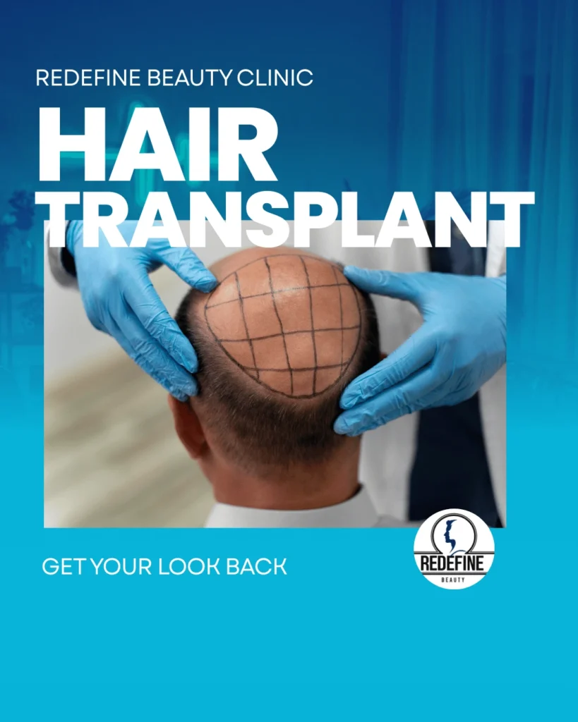 Best Hair Transplant Surgery Doctors In Greater Noida