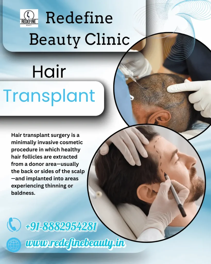 Hair Transplant surgery